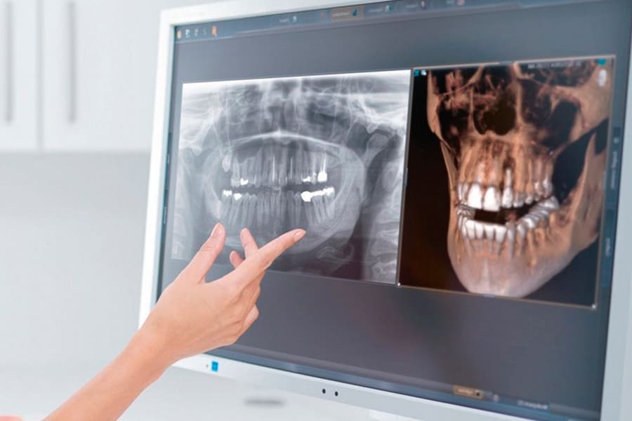 3D томография: новейшие технологии и их применение в медицине