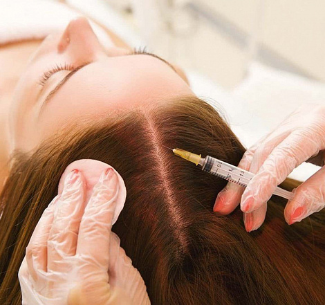 Мезотерапия от выпадения волос: эффективный метод восстановления и роста волос