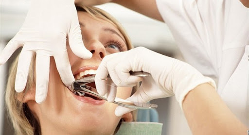 Что нужно знать про удаление зубов